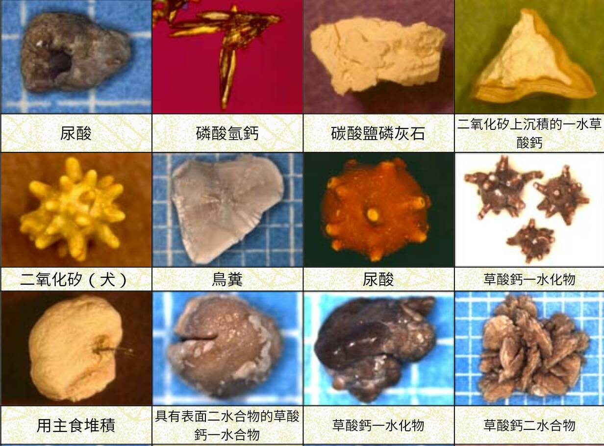 結石態樣圖片一