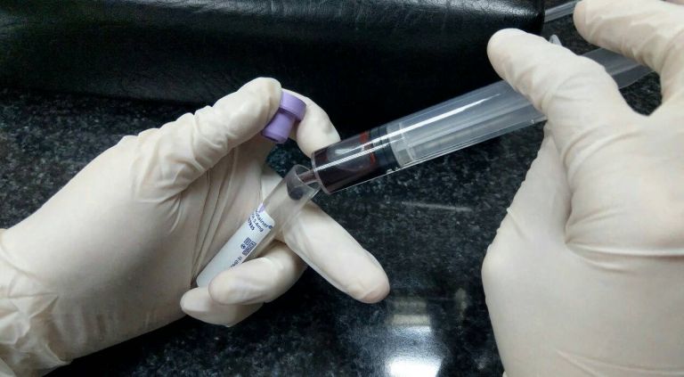 220秒影片透視檢體 認識正確醫療幕後功臣